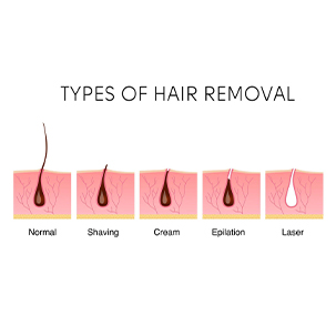 types of hair removal