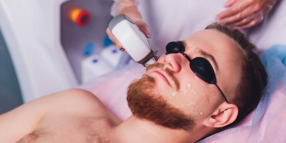 Laser Treatments for Men’s Skin: Addressing Scarring and Imperfections