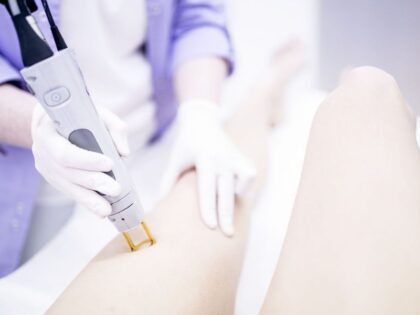 Post-Pregnancy Permanent Hair Removal