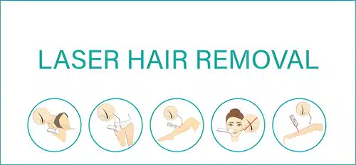 Benefits of Permanent Hair Removal at Grace & Glamour